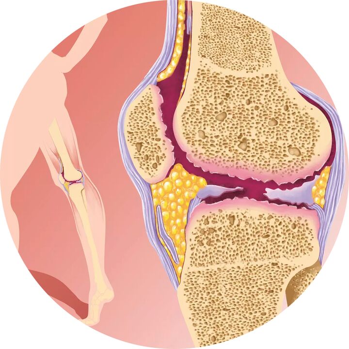 Hondroten - Podporuje pohyblivosť kĺbov