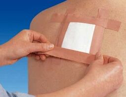 Použitie terapeutickej náplasti na bolesti chrbta